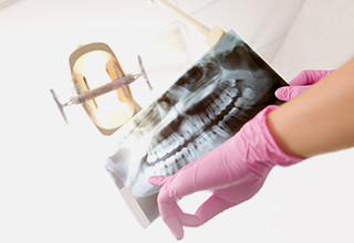 歯科用X線CT